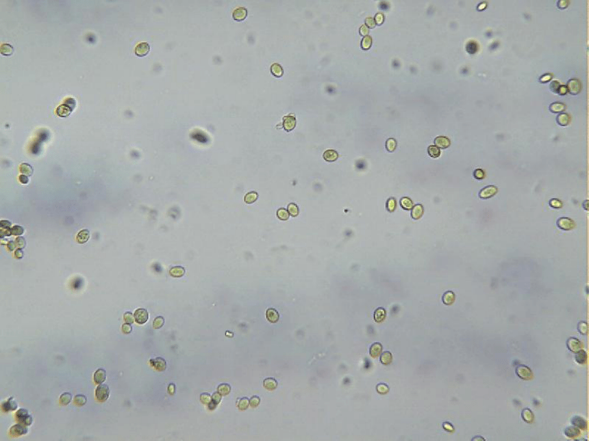 显微镜下的酵母菌图图片