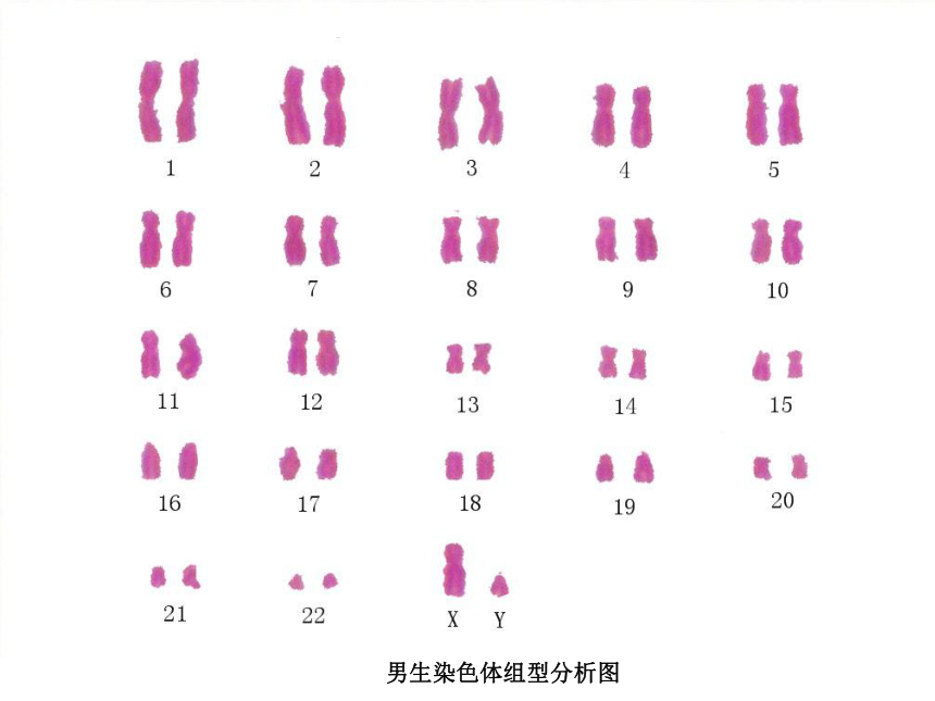 高中生物人教版必修二第五章第2节 染色体变异 课件（66张PPT）