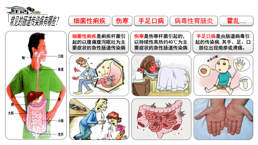 青岛版（五四制2017秋）四年级科学上册 4.17肠道传染病 （课件共12张PPT）