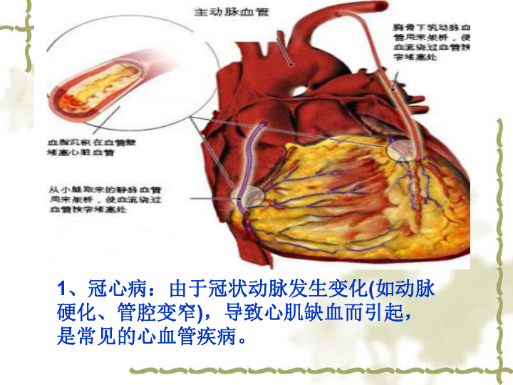 北师大版生物七下13.4《当代主要疾病和预防》授课课件(共23张PPT)