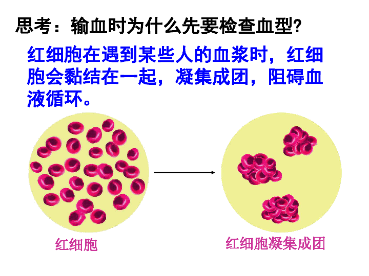 初中生物第四节输血与血型课件(共17张PPT)