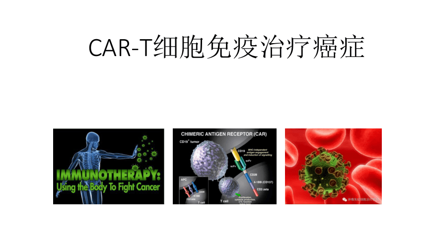 2020-2021学年高中生物竞赛动物细胞工程CAR-T细胞免疫治疗癌症课件（共30张PPT）