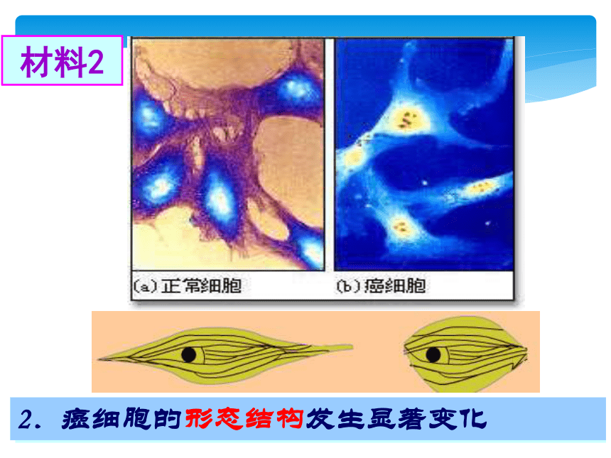 人教版高中生物必修一分子与细胞第六章细胞的生命历程第4节细胞的癌变 （共33张PPT）