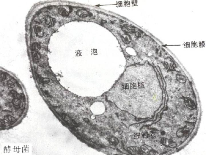 霉菌的形态结构图图片