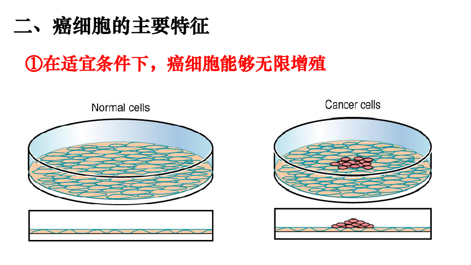 人教版必修1第6章第4节 细胞的癌变20PPT