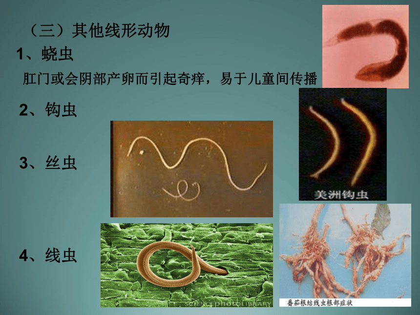 512线形动物和环节动物教学课件15张ppt