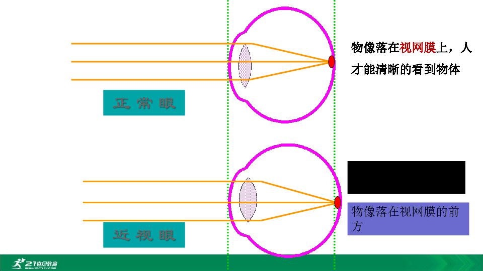 2020年春人教七下生物第六章第一节近视与远视 教学课件