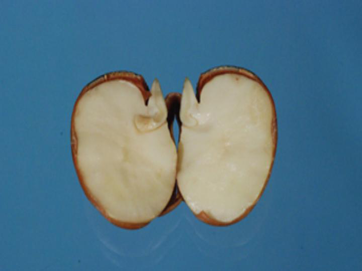 苹果种子剖面图图片