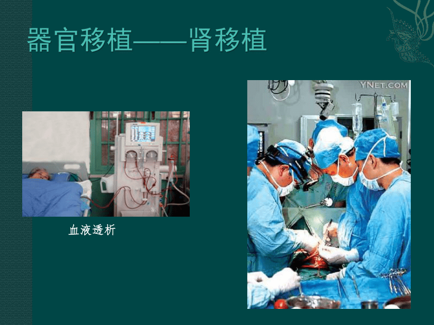 生物：中图版选修二 312 器官移植（课件）