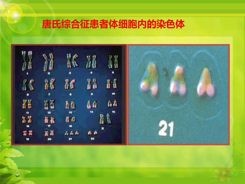 6.2.3 遗传病与优生 课件（共29张PPT）