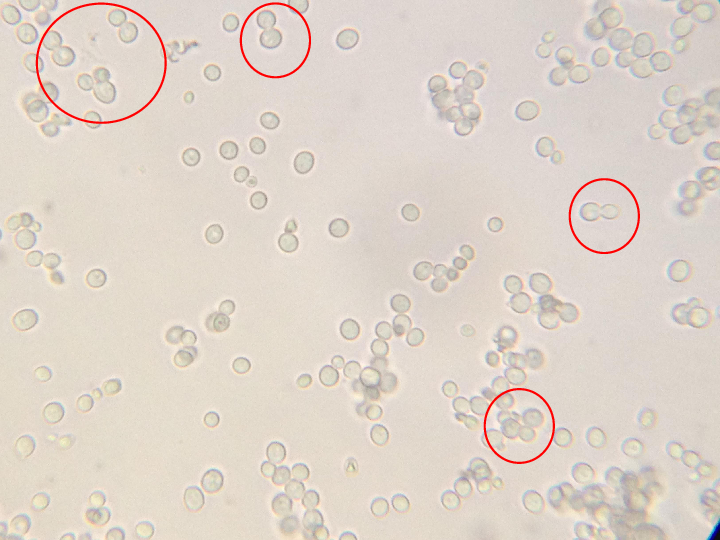 兔子酵母菌显微镜图片图片
