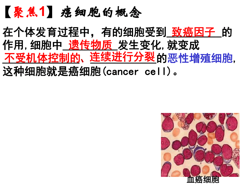 人教版高一生物必修1课件：6.4 细胞的癌变 （共25张ppt）